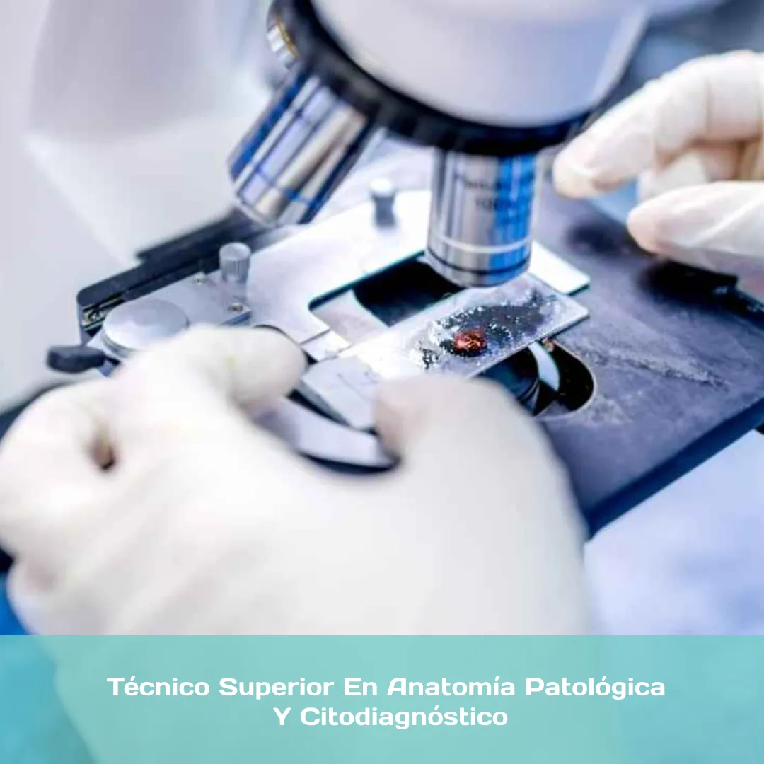 Técnico Superior en Anatomía Patológica y Citodiagnóstico